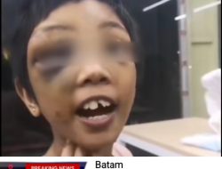 Gadis Belia 9 Tahun Menjadi Korban Penganiyaan Ibu Tiri